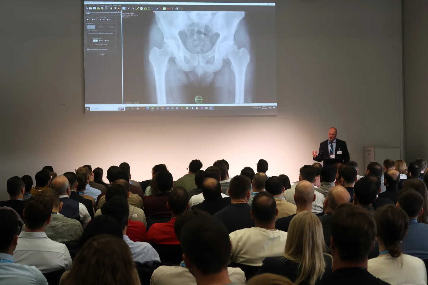 Digitale Planung einer Hüftendoprothese