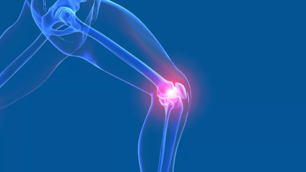 Patientenfragen Knie-Operation
